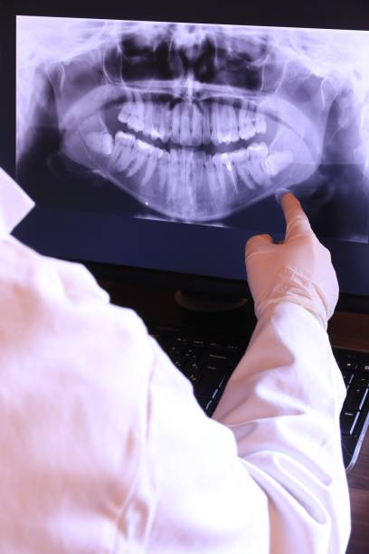 Best Emergency Root Canal Treatment in Hydesville, CA